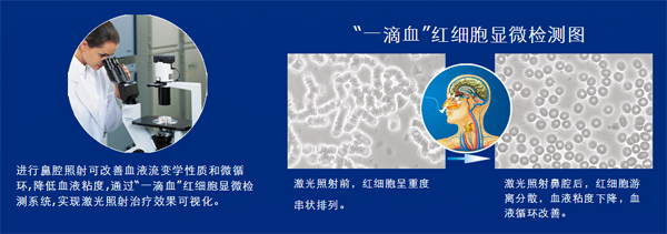 生活中哪些現(xiàn)象說明你的血液粘稠？-激光理療儀“一滴血”實(shí)驗(yàn)-康興醫(yī)療器械官網(wǎng)